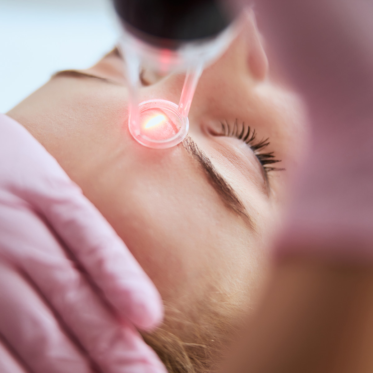 Laserbehandlung