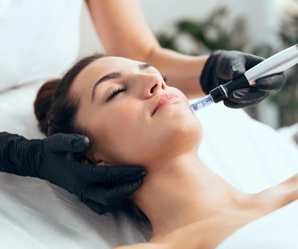 Microneedling